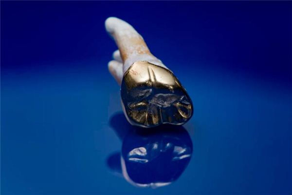 The meaning and symbol of gold-inlaid teeth in dreams