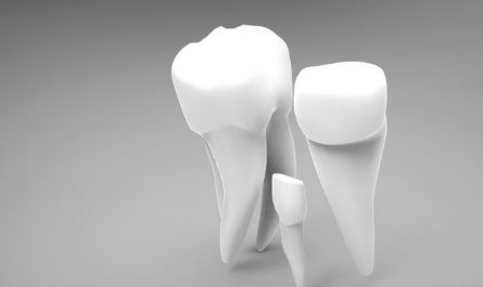 10 Symbolic Meanings of Dreaming About Upper Teeth