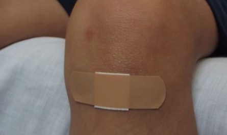 What does it symbolize to dream of being bitten?